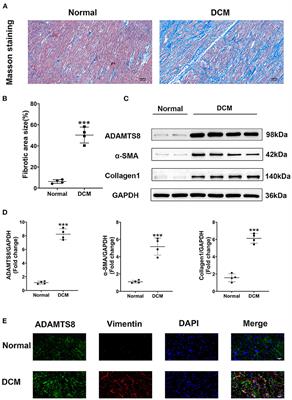 ADAMTS8 Promotes Cardiac Fibrosis Partly Through Activating EGFR Dependent Pathway